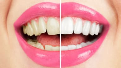 Чем можно отбелить зубы в домашних условиях не повредив эмаль?